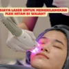 Berapa Biaya Laser Untuk Menghilangkan Flek Hitam di Wajah?