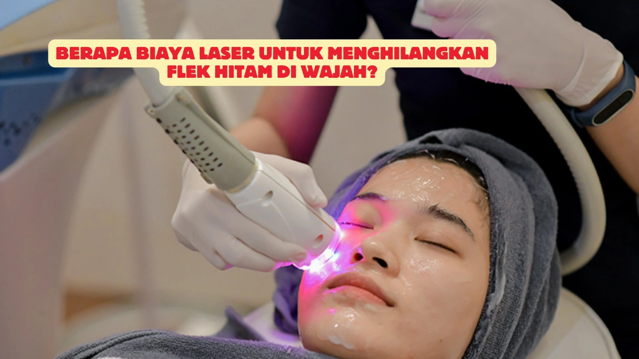 Berapa-Biaya-Laser-Untuk-Menghilangkan-Flek-Hitam-di-Wajah